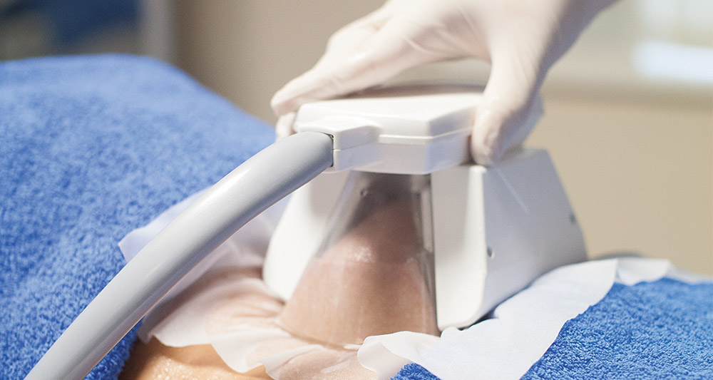 Multiple Areas in One Session HIFU and Fat Freezing Ramsgate