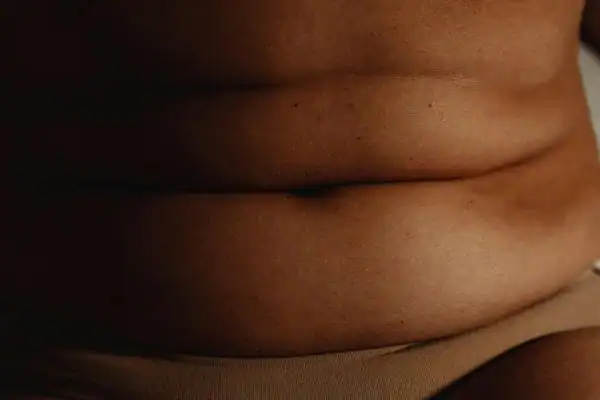 image of what stress can do on the stomach area and how Lipo 360 Ramsgate can help to change your body shape.