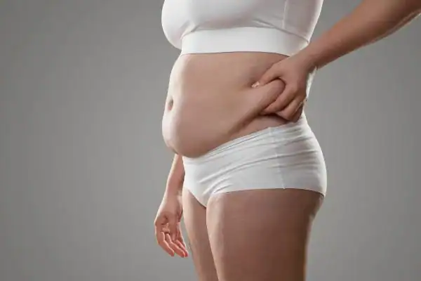 Image of stress belly Ramsgate How Lipo 360 can help manage your symptoms