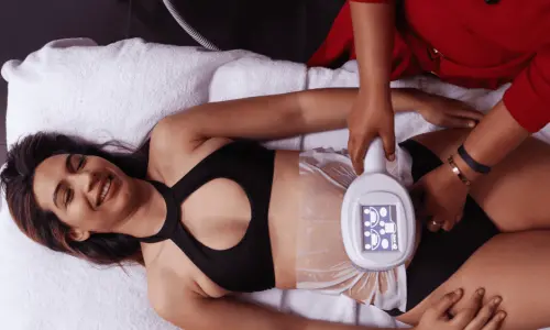 Woman having Body Sculpting treatment post injury Ramsgate
